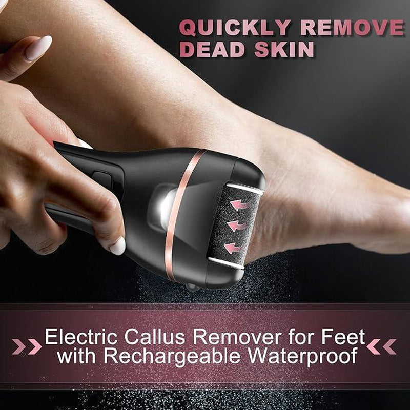 Electric Callus Remover